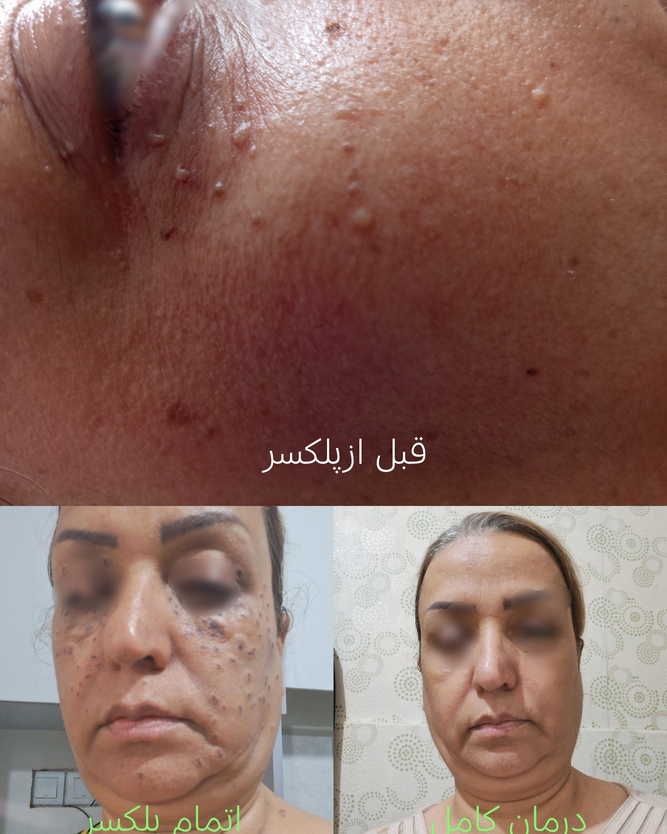 کاور پروفایل فروغ باقری — تصویر 1