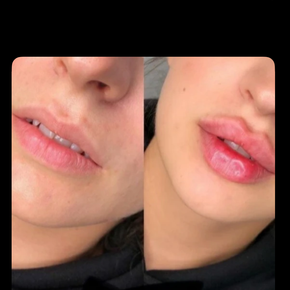 نمونه کار رضوان موسوی — لیفت و لمینت مژه