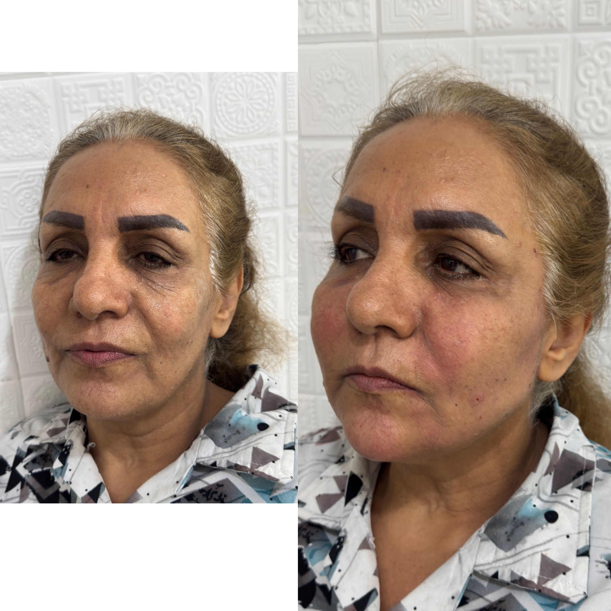 نمونه کار رضوان موسوی — لیفت و لمینت مژه