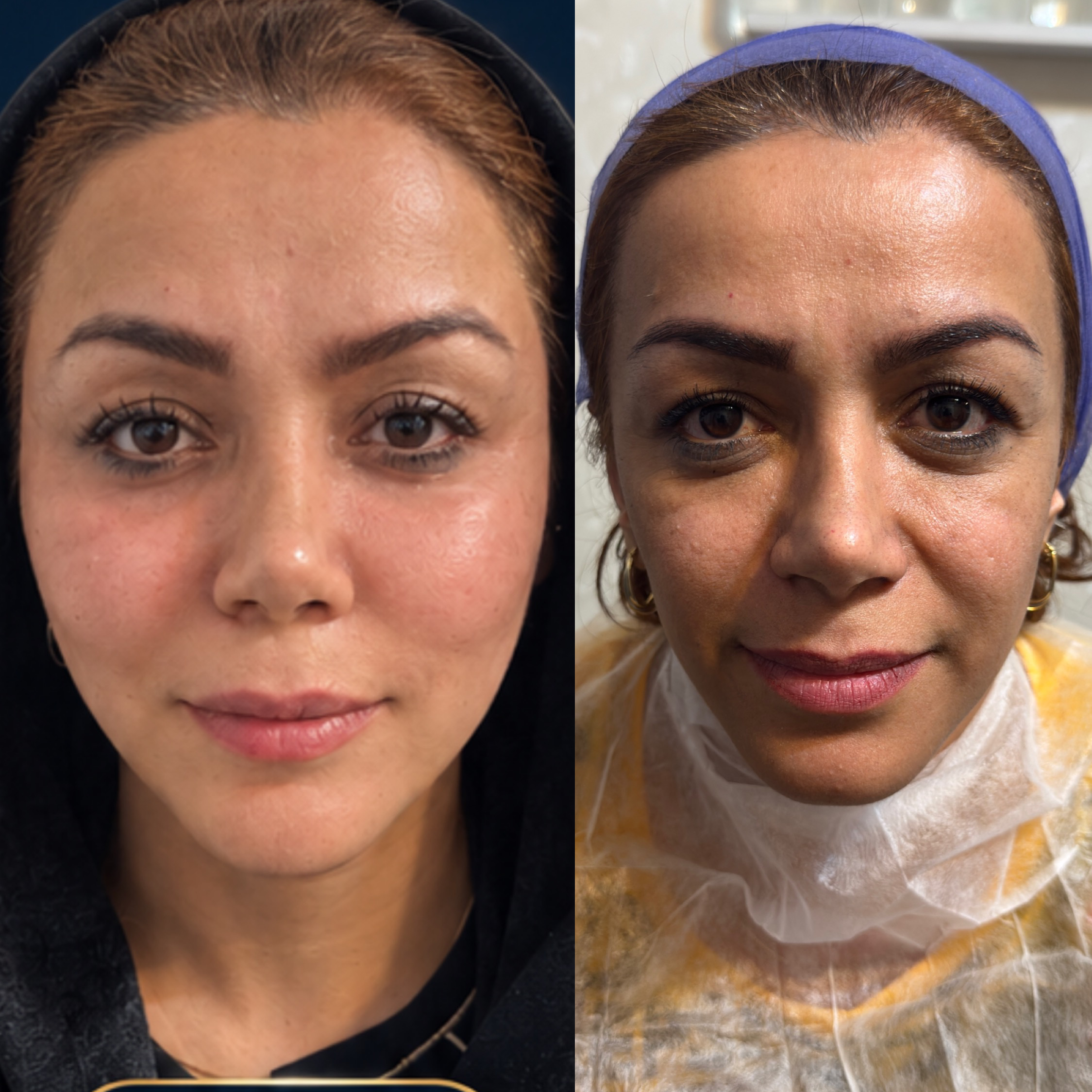 نمونه کار رضوان موسوی — لیفت و لمینت مژه