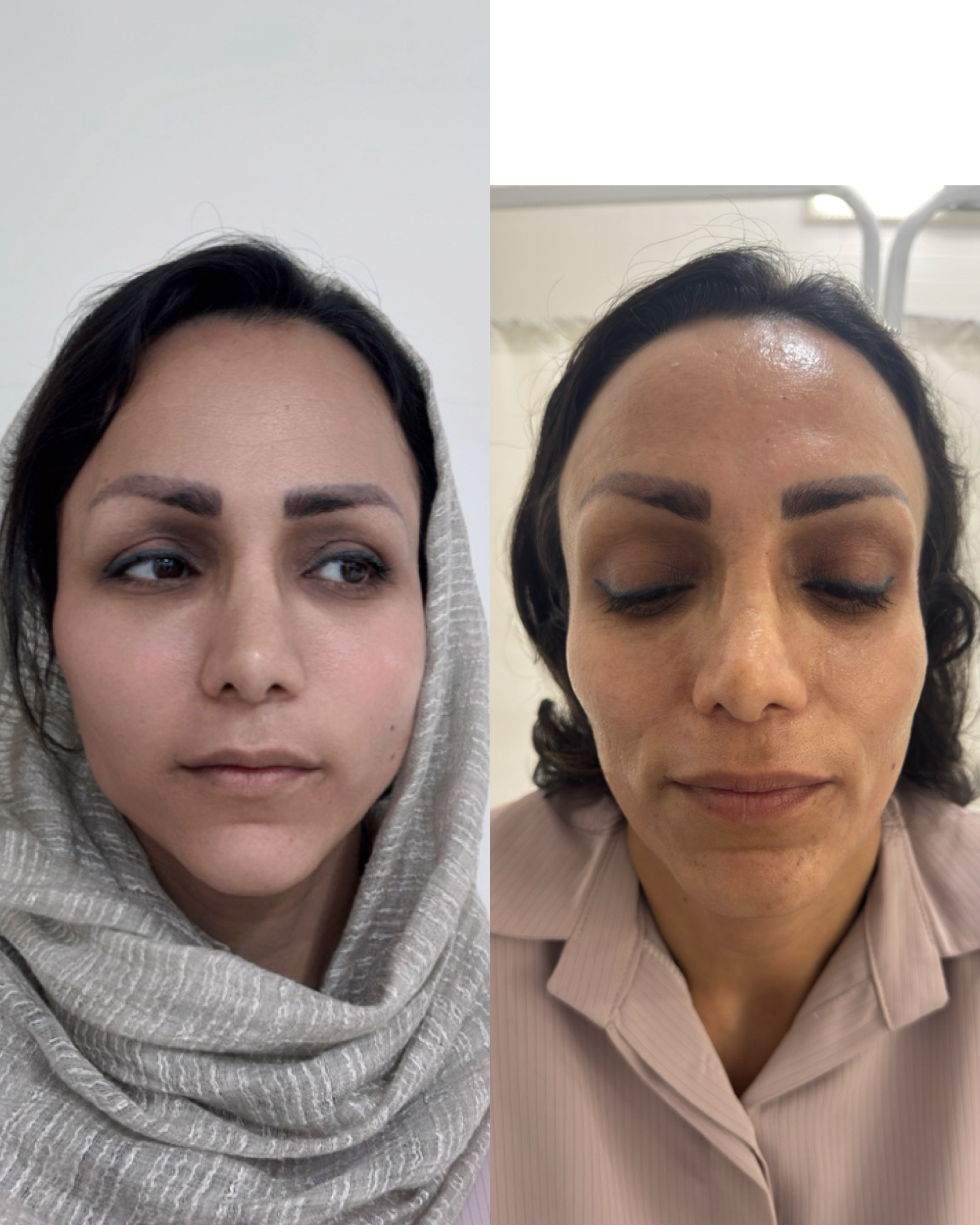 نمونه کار رضوان موسوی — لیفت و لمینت مژه