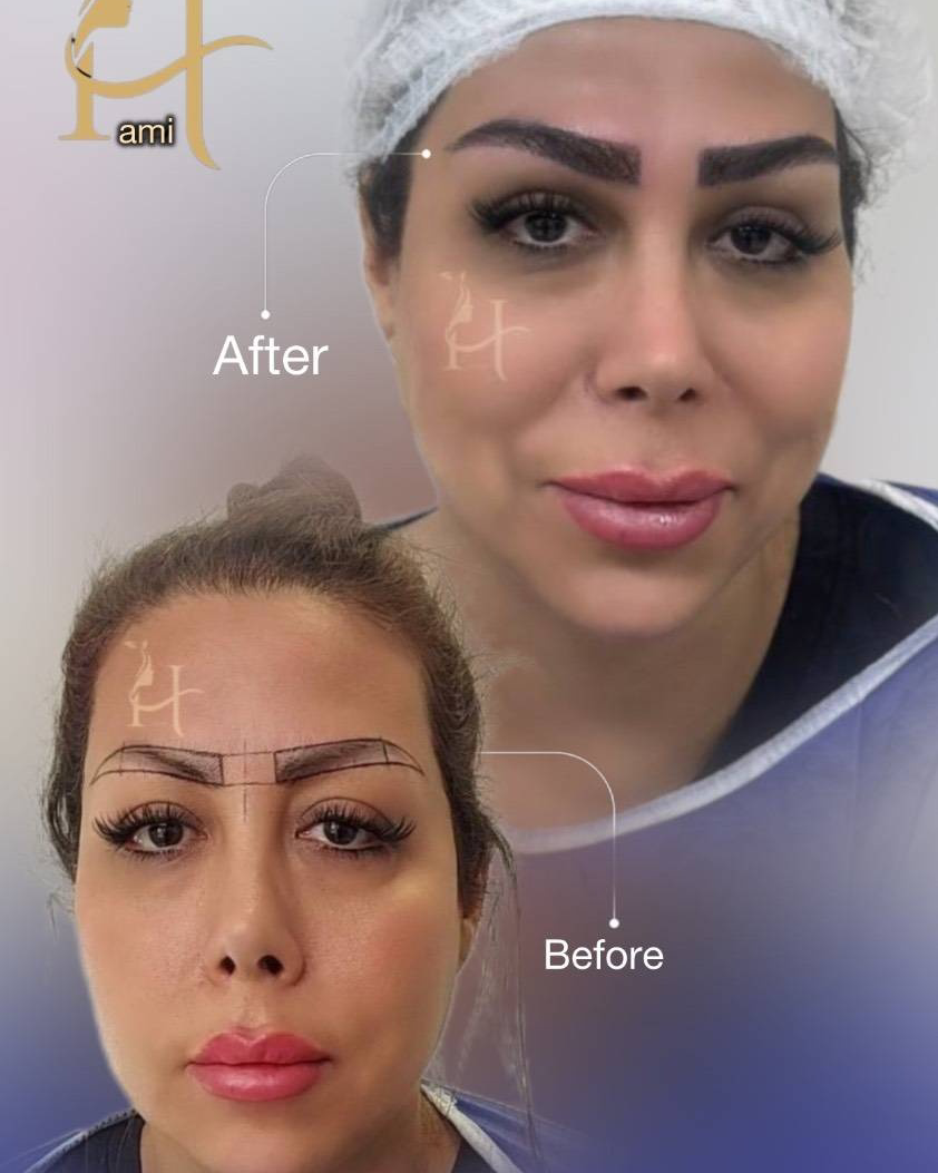 نمونه کار مژگان سجادی — لیفت و لمینت مژه