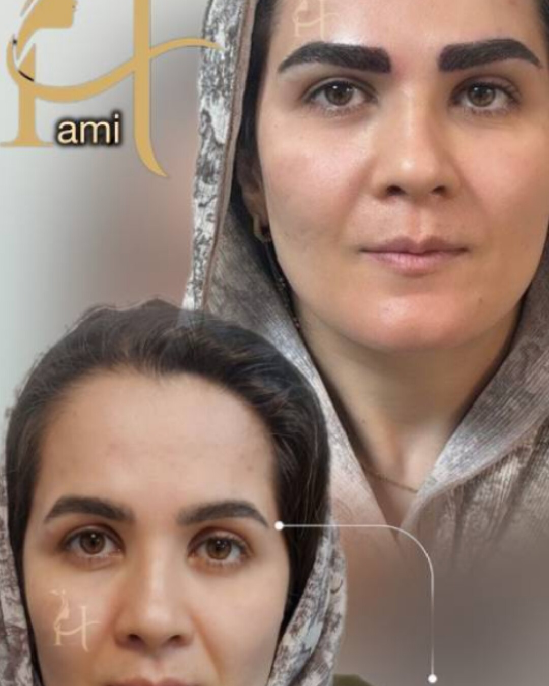 نمونه کار مژگان سجادی — لیفت و لمینت مژه