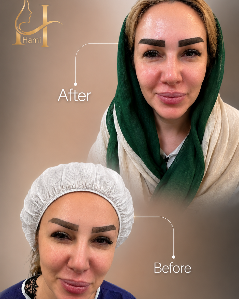 نمونه کار مژگان سجادی — لیفت و لمینت مژه