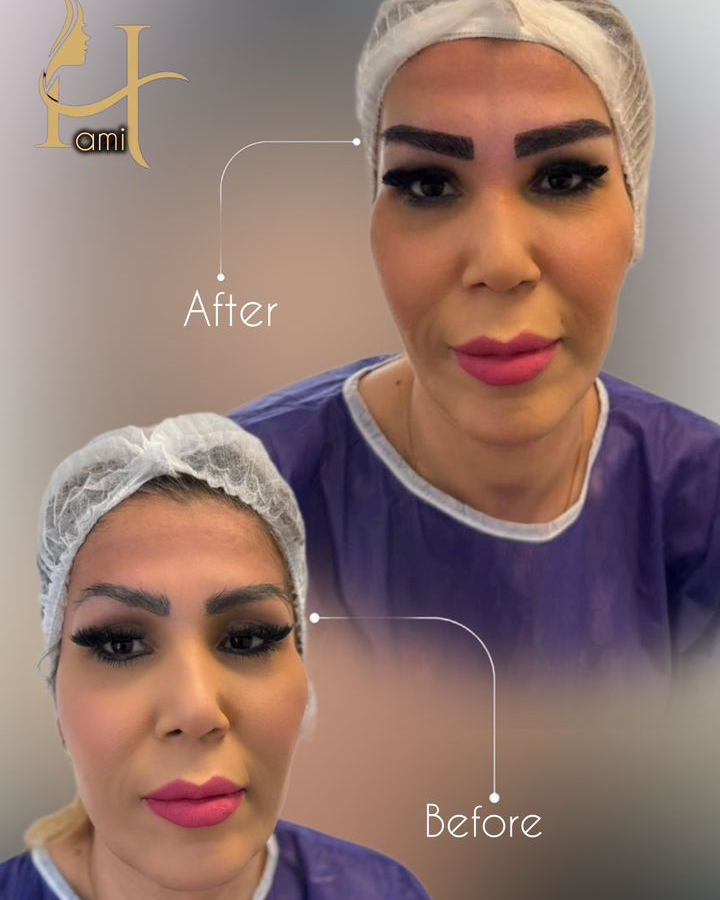 نمونه کار مژگان سجادی — لیفت و لمینت مژه