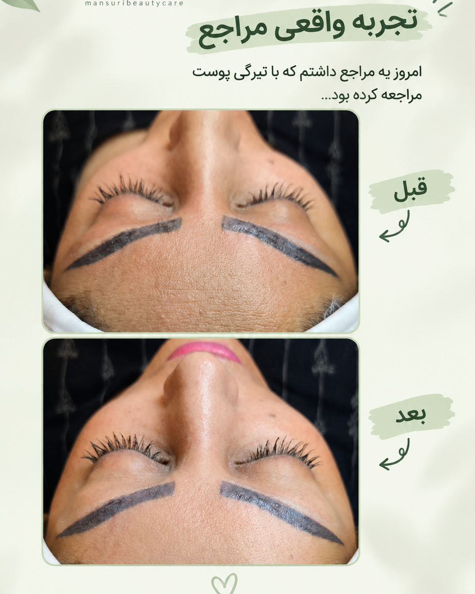 نمونه کار معصومه منصوری مهربانی — لیفت و لمینت مژه